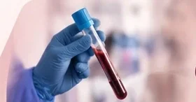 A gloved hand holding a blood sample tube.